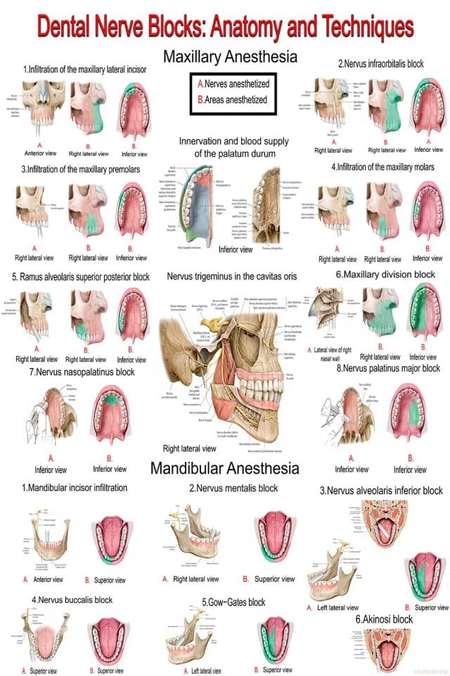 Dental Nerve Block Anatomy Poster