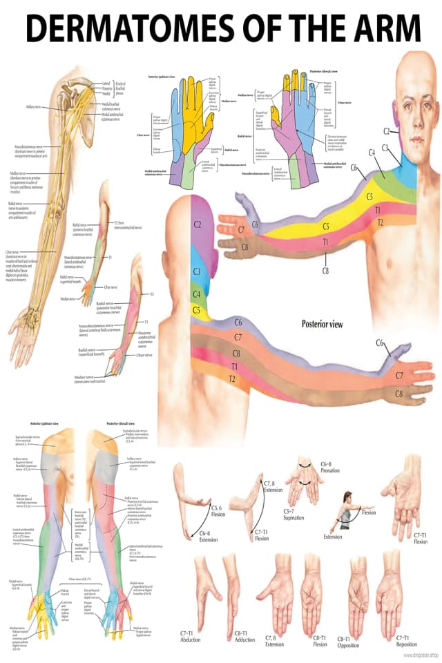Arm Dermatomes Anatomy Poster