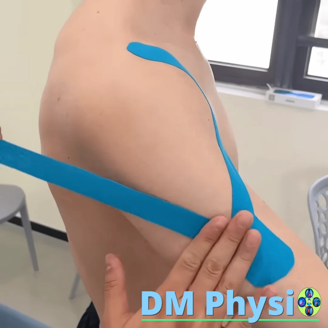 Приложение на кинезио тейп