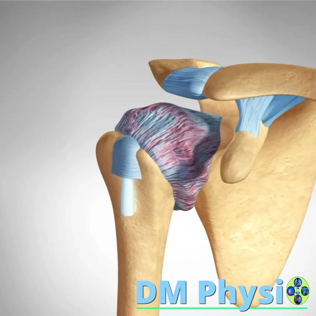 Замръзнало рамо – болка и ограничен обем