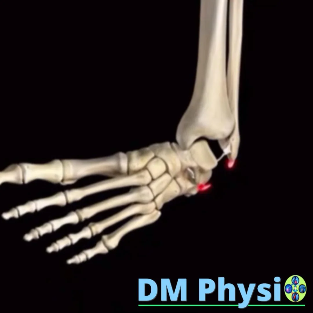 Инверзия на глезен