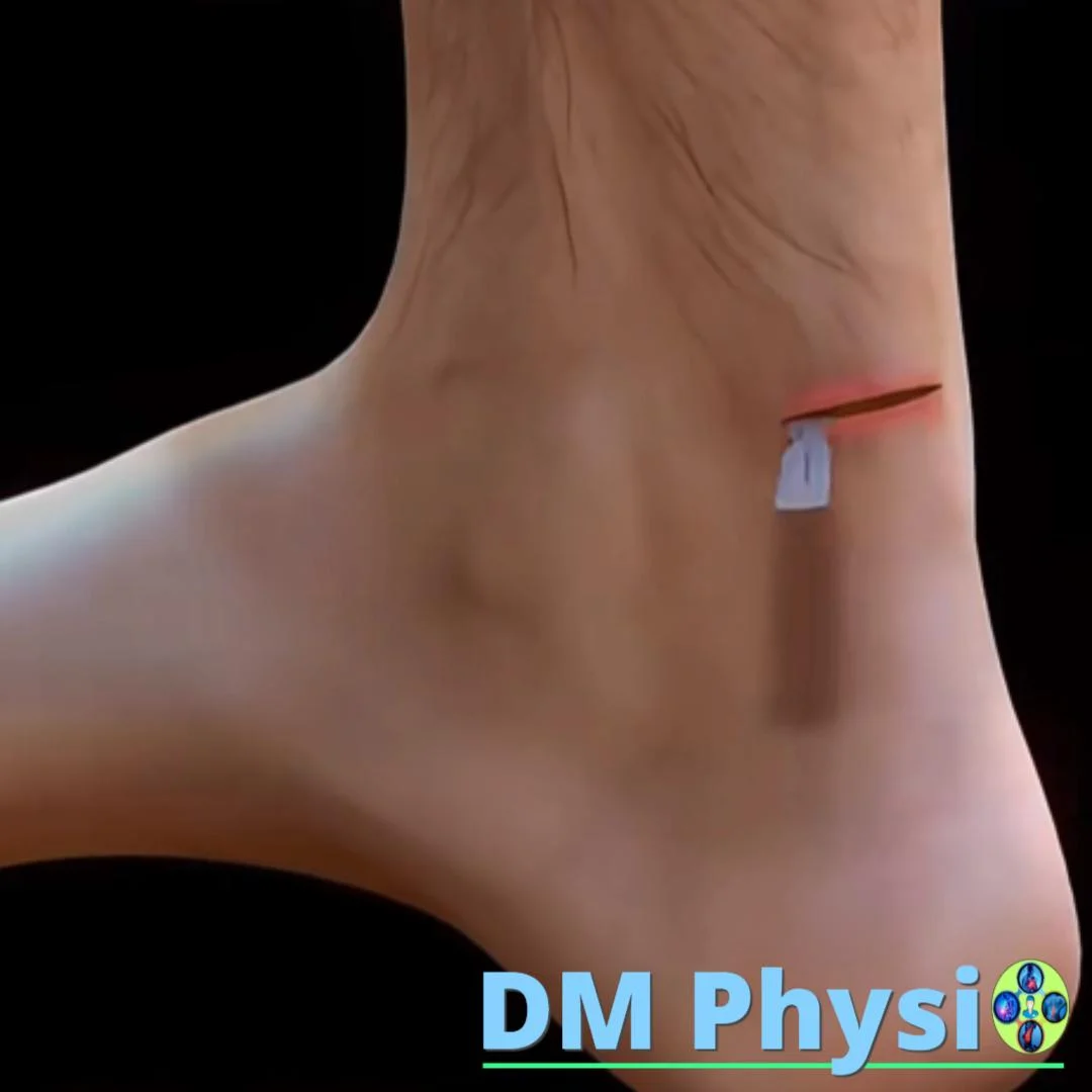 Операция/консервативен подход