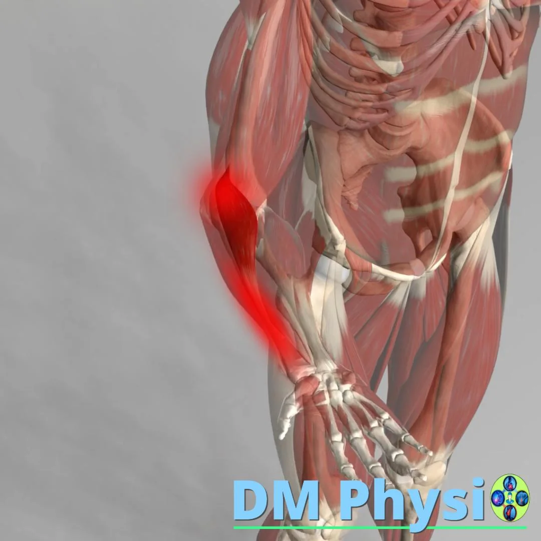 Брахиорадиалис мускул