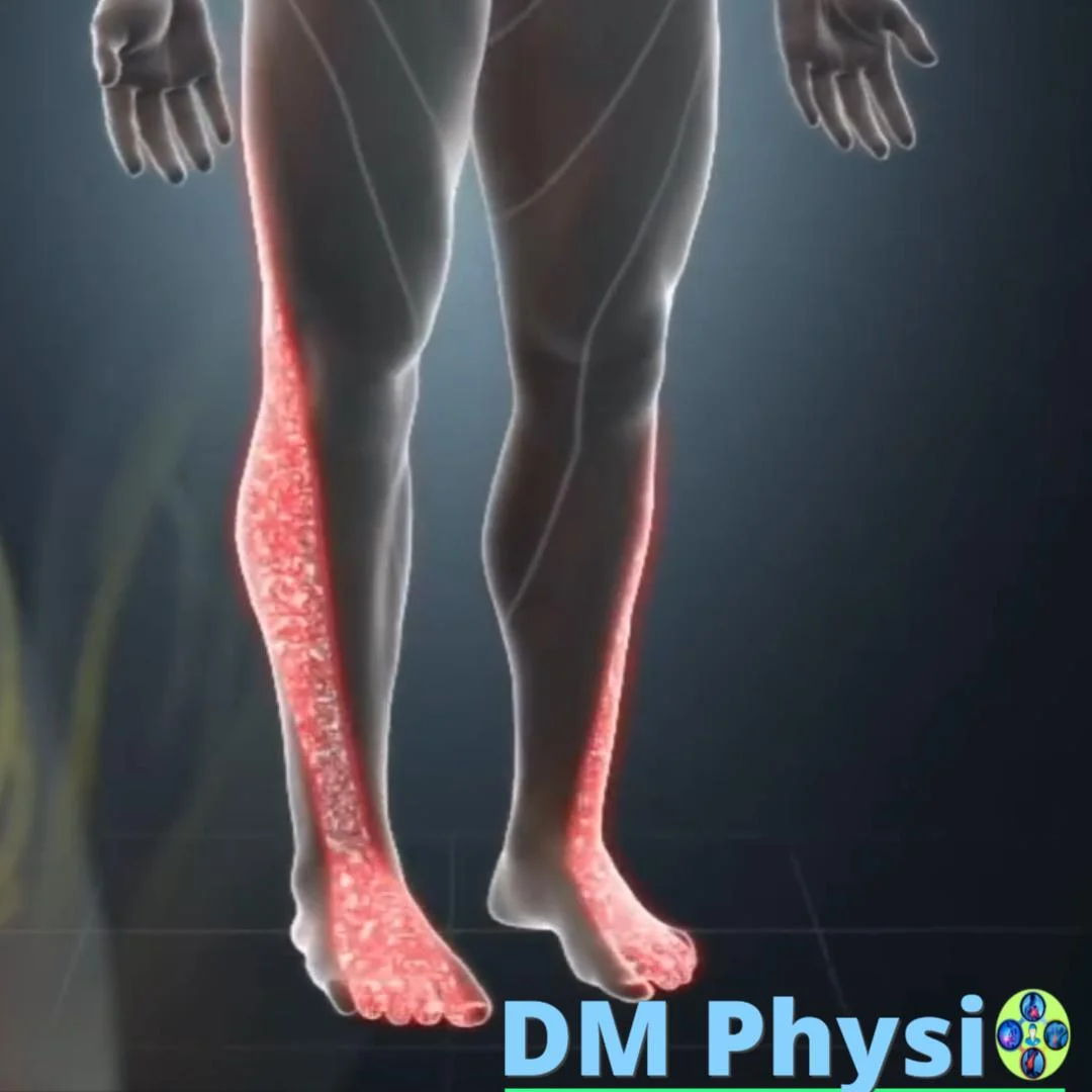 Невралгии на крака – бедро и коляно