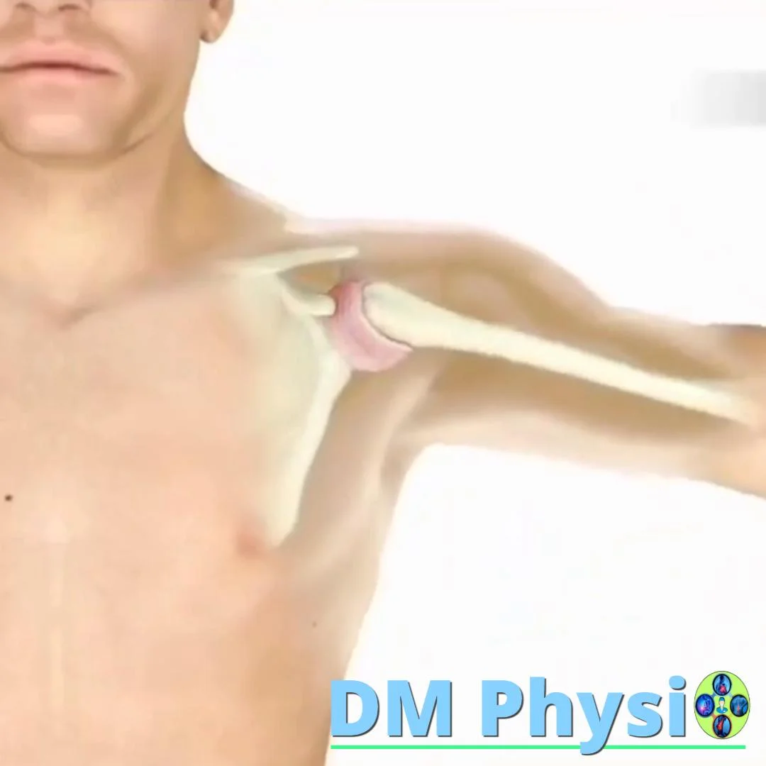 Болка при замръзнало рамо