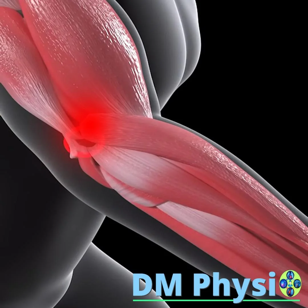 Анатомия на голф лакът