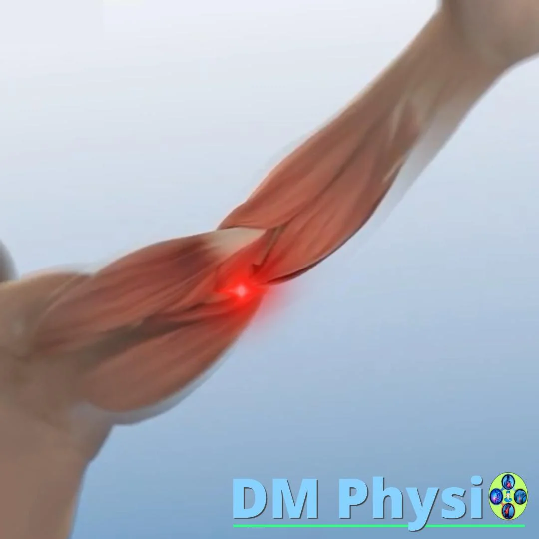 Тенис лакът