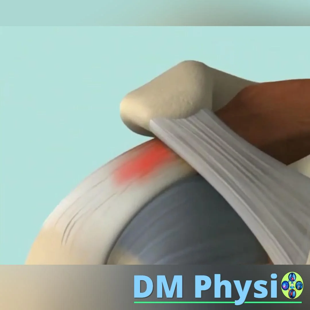 Anatomy of the shoulder joint
