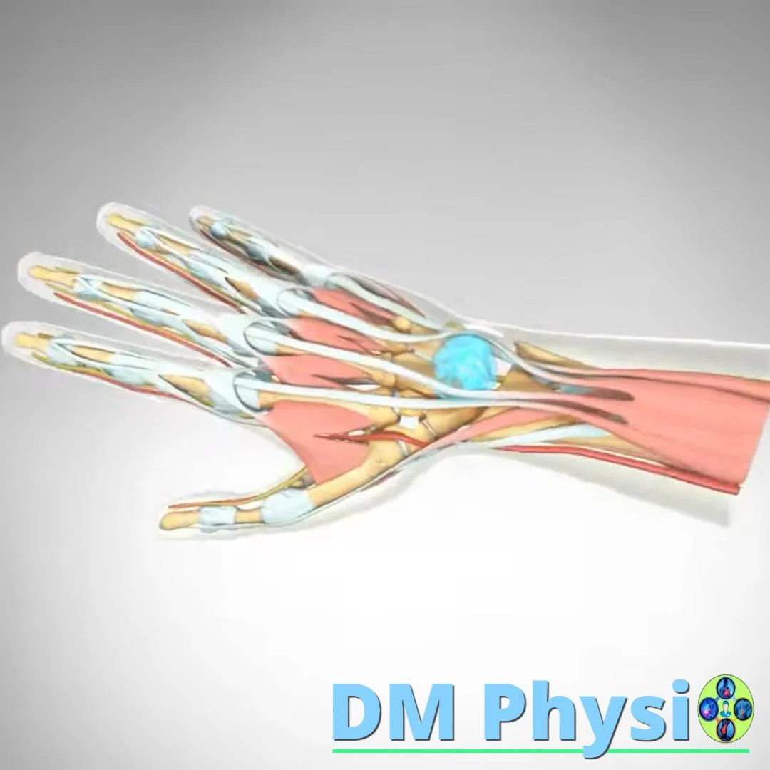 Анатомия на киста на ръката