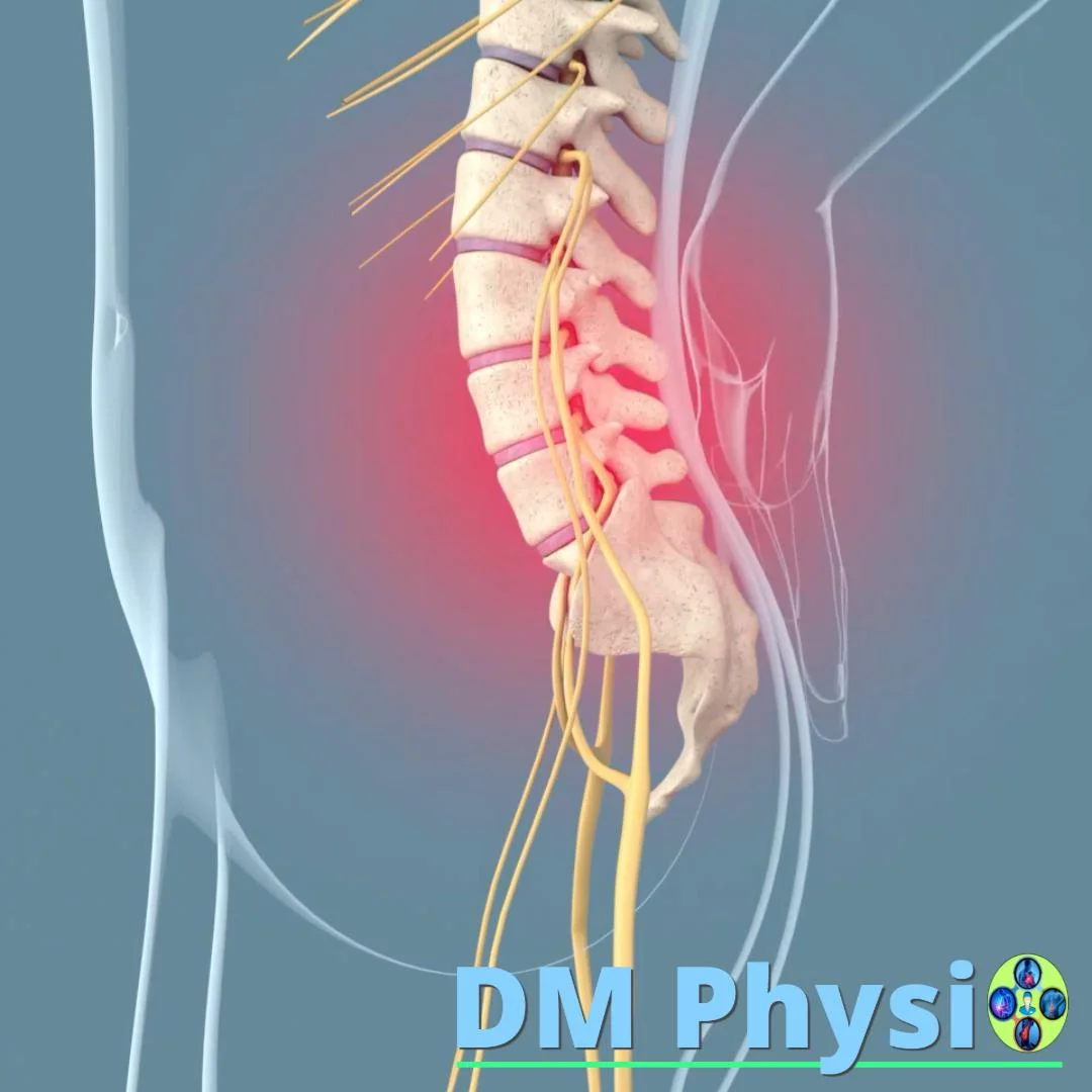 Дискова херния на кръста
