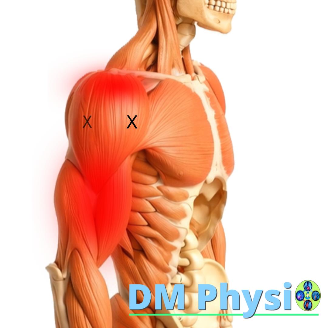 Изображение на Делтоидния мускул
