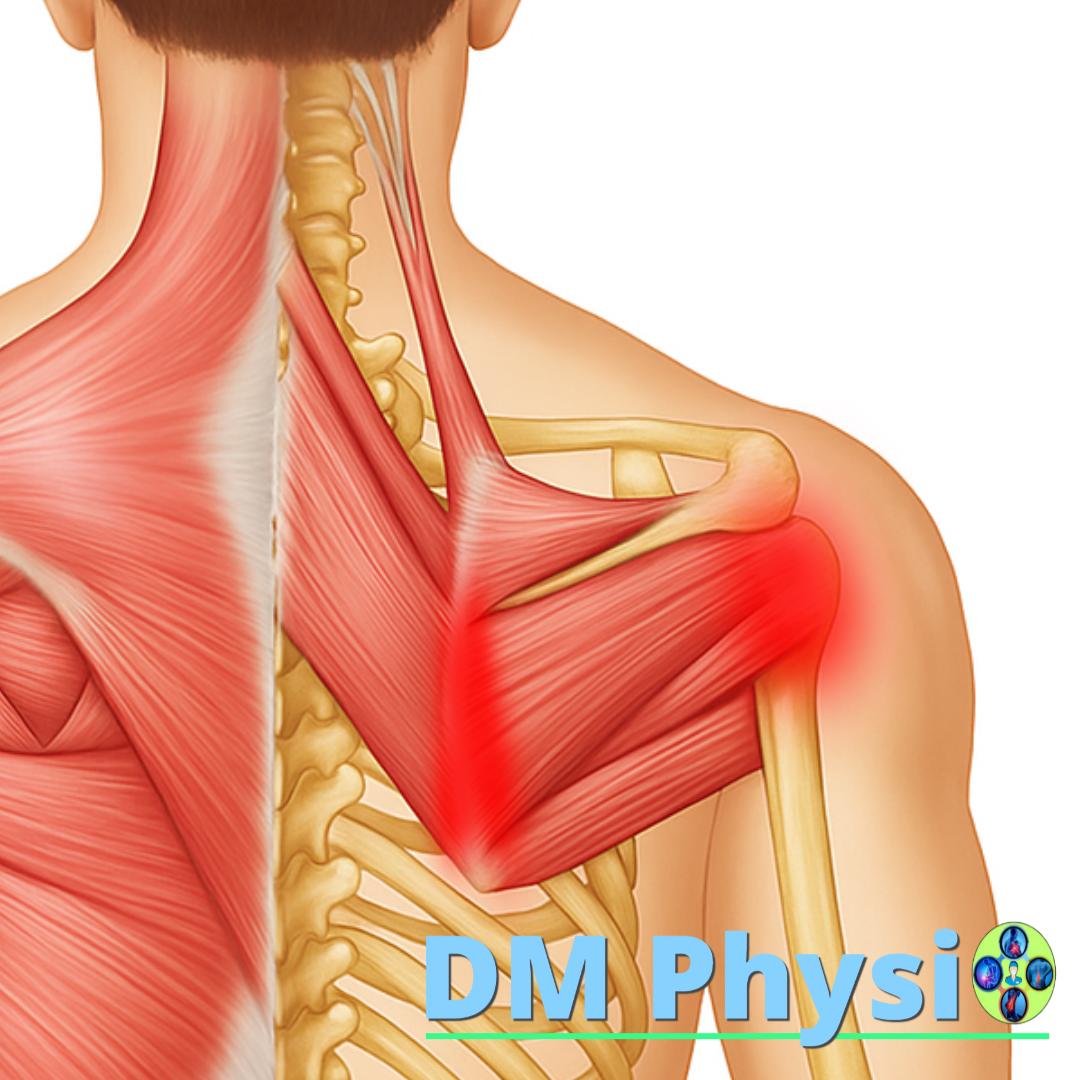 Изображение на мускулите infraspinatus и teres minor