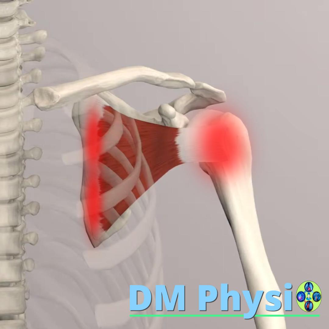 Изображение на мускула subscapularis