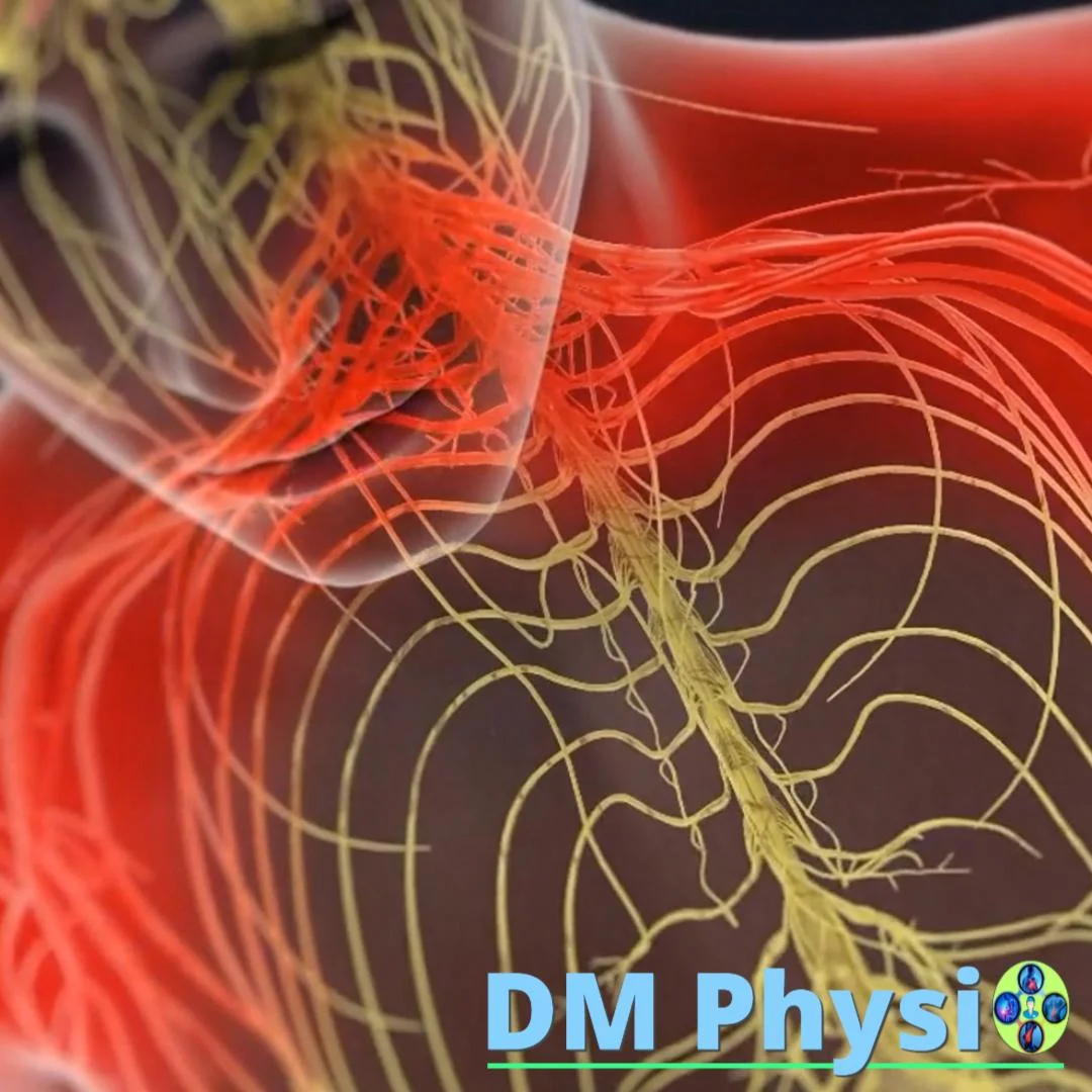 Радикулопатия на врата – изтръпване и болка по ръката