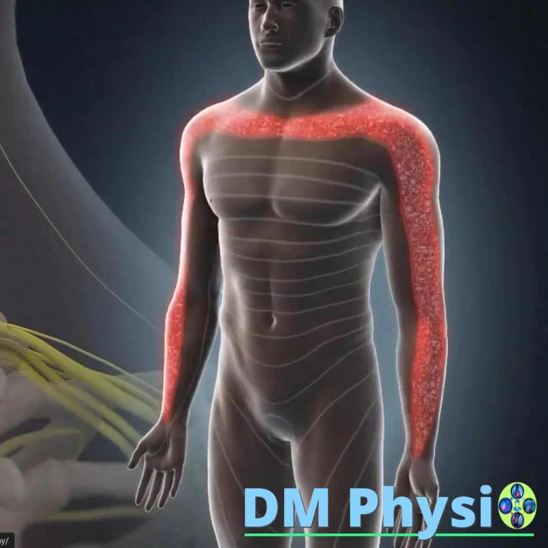 Хронична болка при шийна радикулопатия