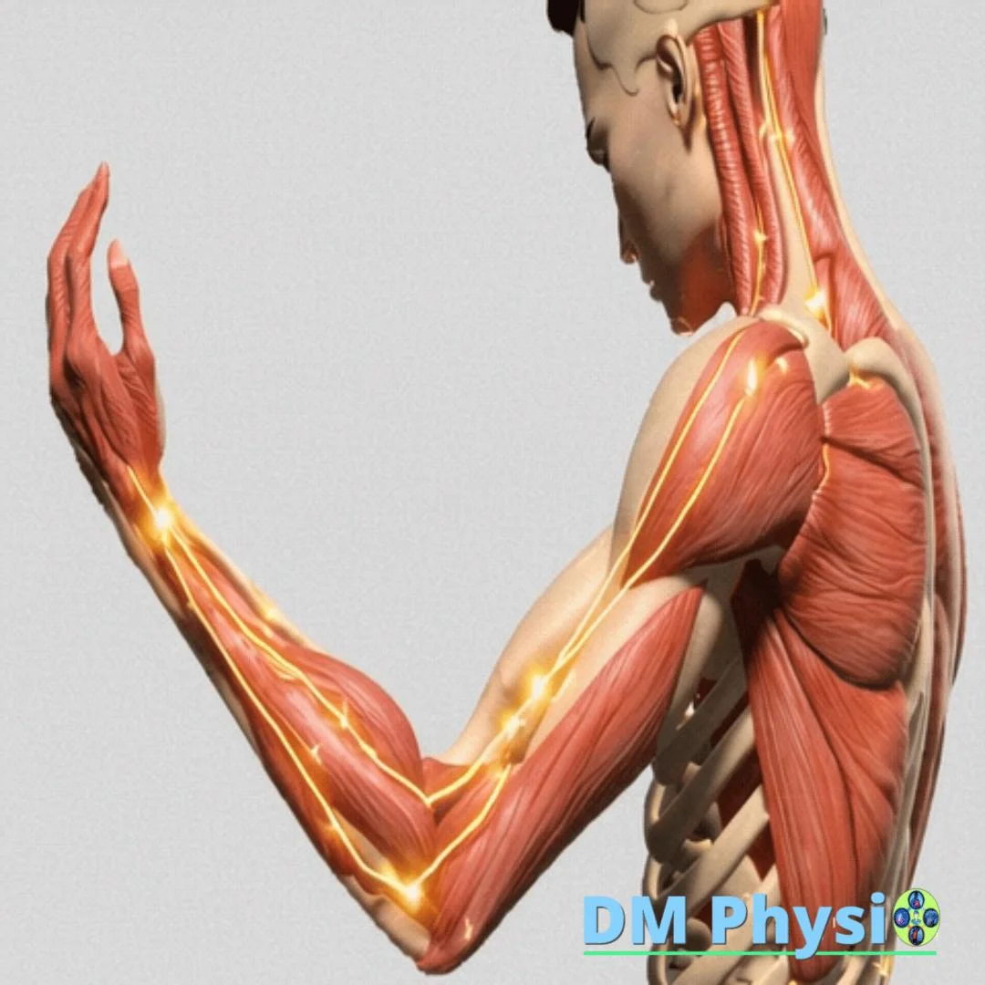 Радикулопатия на врата – изтръпване и слабост