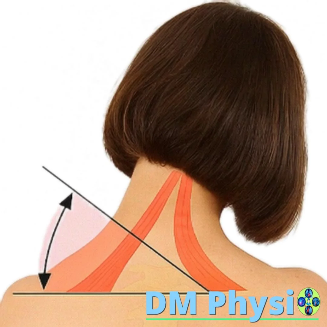 Мускулен дисбаланс