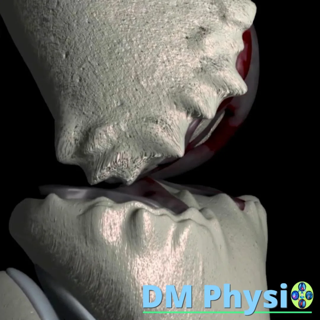 Шипове на врата