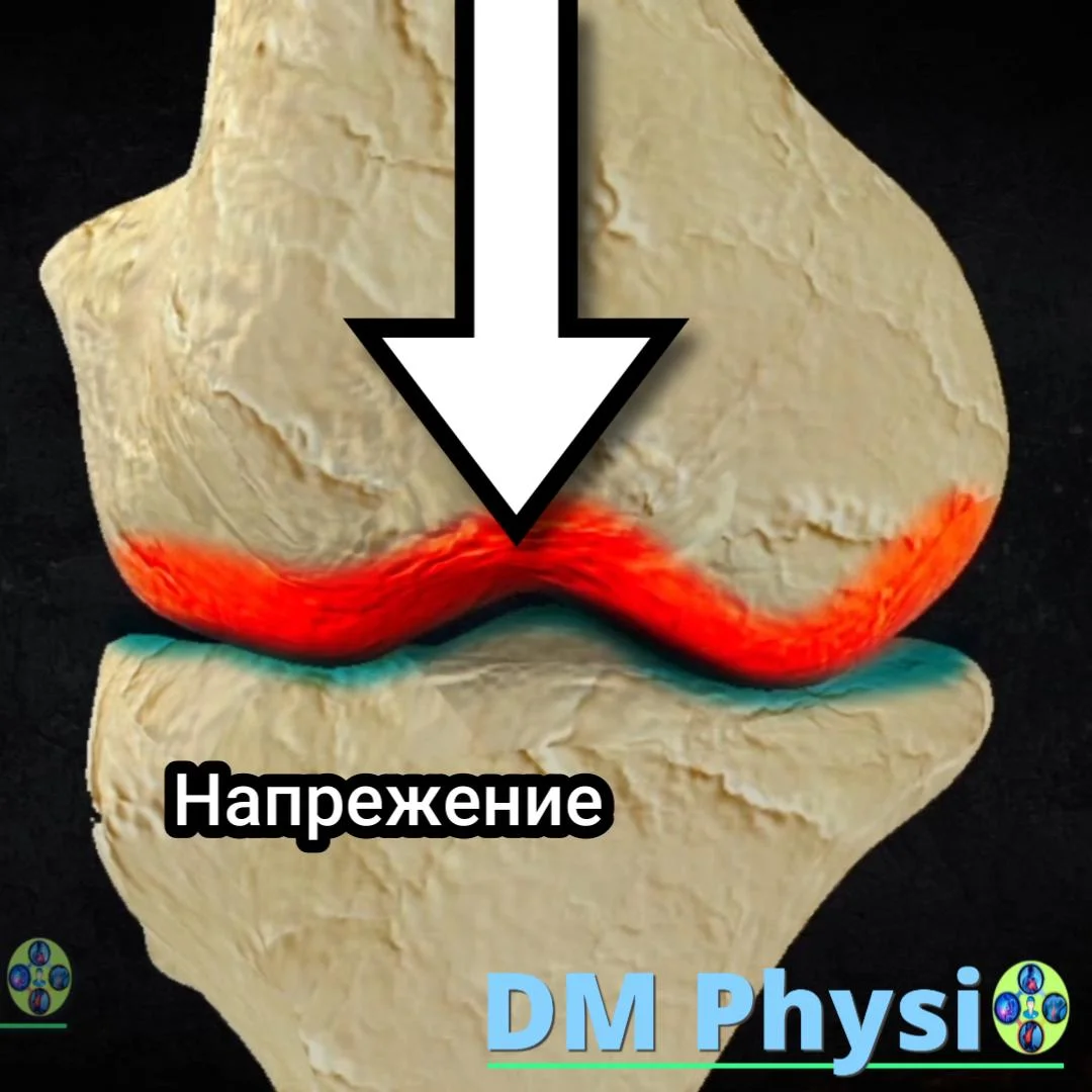 Лумбална болка и дегенерация