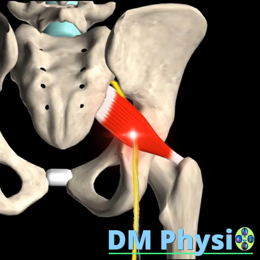 Пириформис синдром – визуализация на мускула и нерва