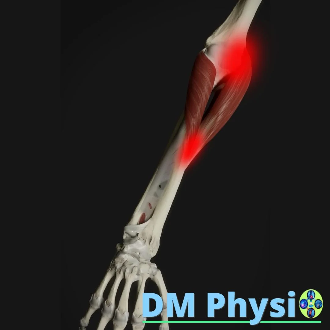 Пронатор терес мускул