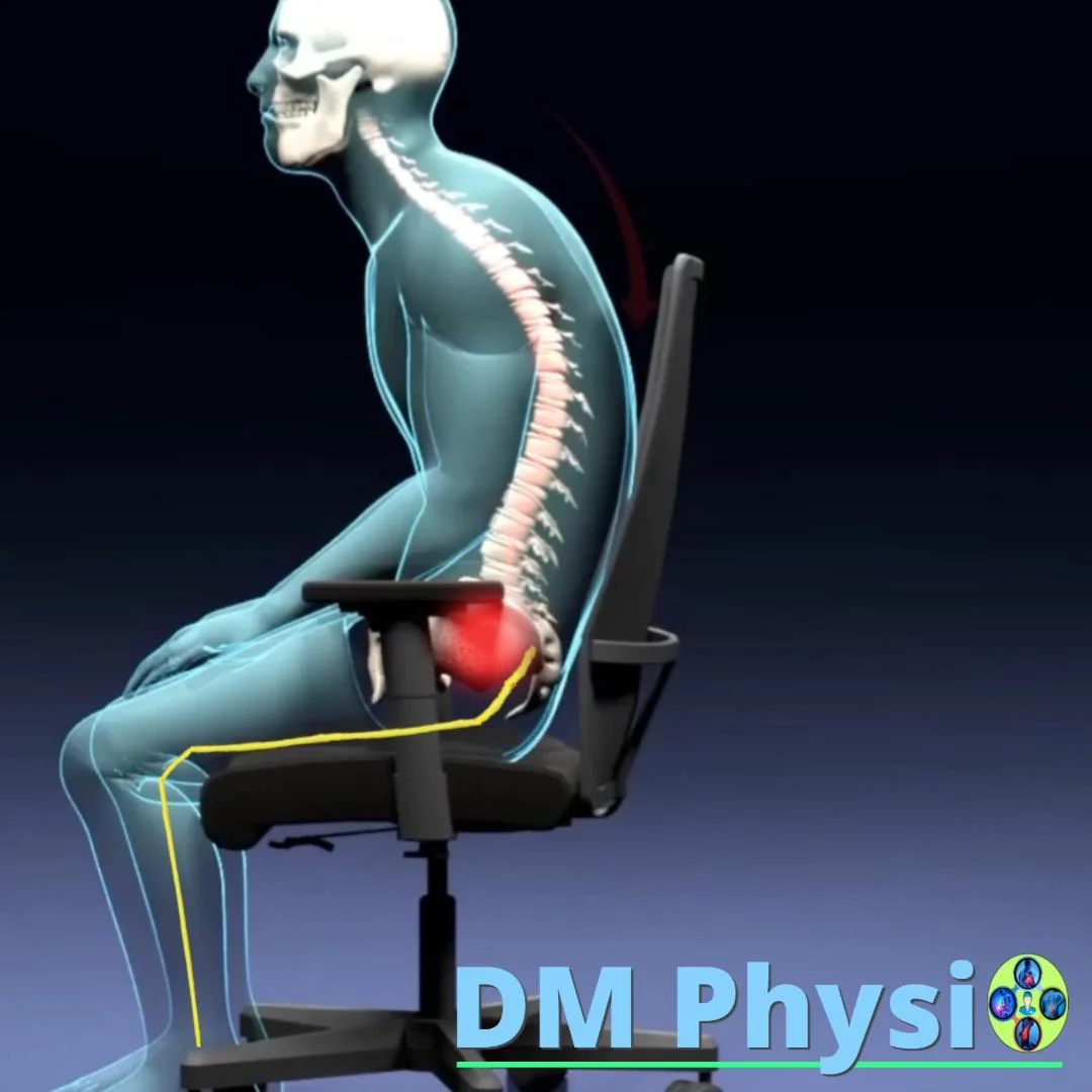 Невралгии на таза – седалищни болки, изтръпване