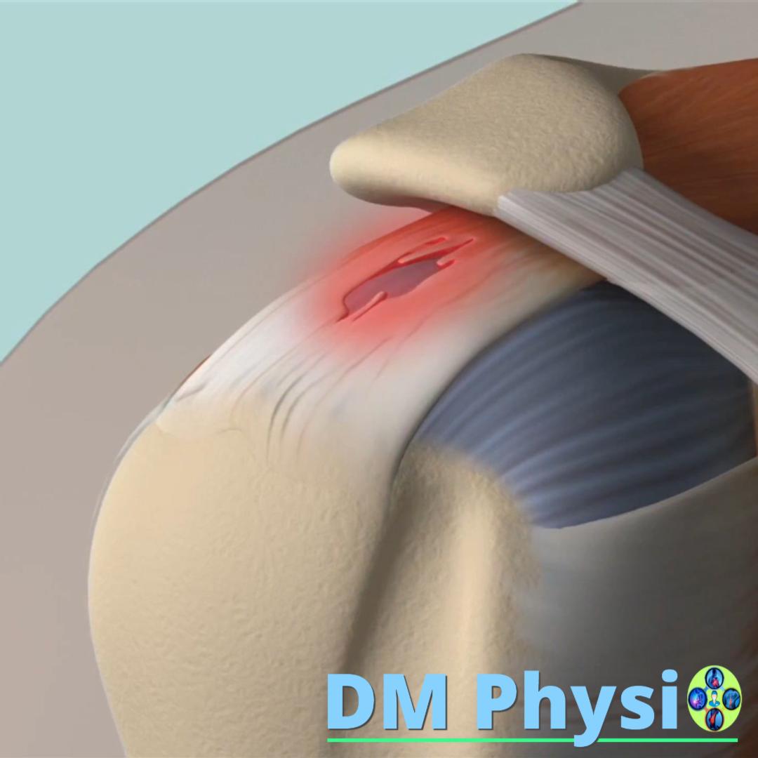 Анатомия на раменния пояс - статично изображение