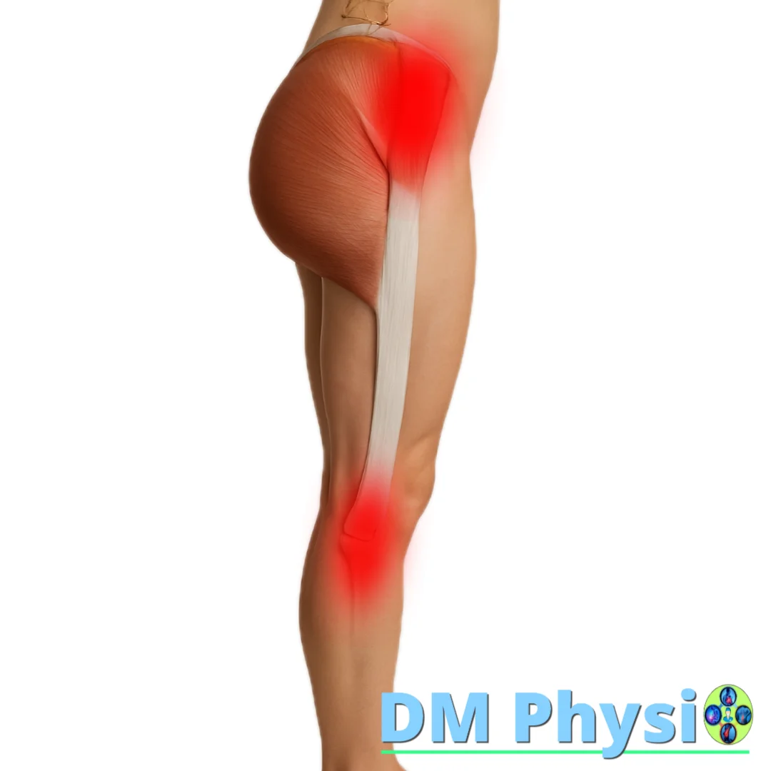 Изображение на мускула тензор на широката фасция